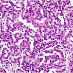 Papillary Cell Low Slide Photo